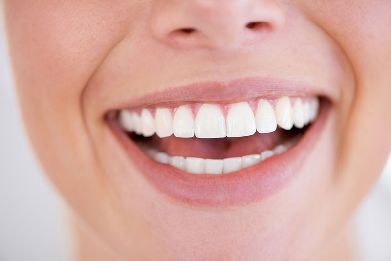 women smiling with bright white teeth and beautiful smile