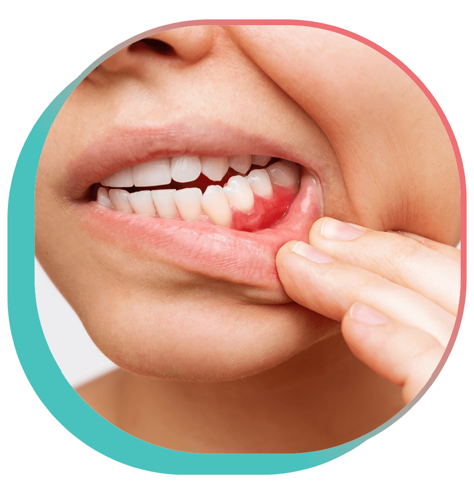 Cropped shot of a young woman showing red bleeding gums