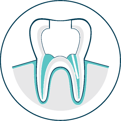root canal procedure assets icon