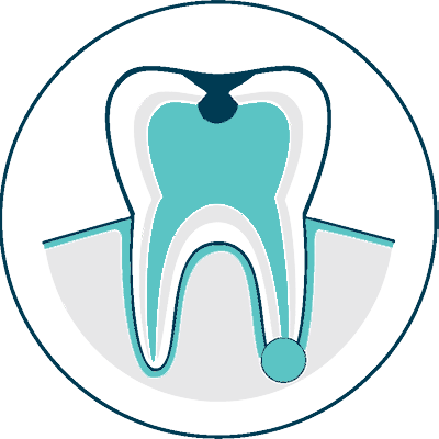 root canal procedure assets icon