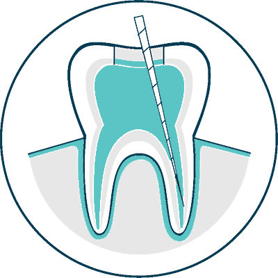 root canal procedure assets icon