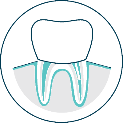 root canal procedure assets icon