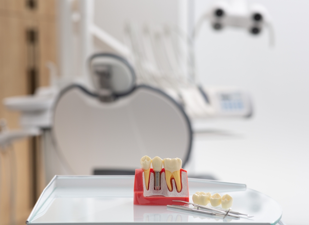 Close up angled shot of a dentist placing a titanium implant into a patient's jawbone, with the abutment visible. The scene should be clinically clean and well-lit. No text on the image.